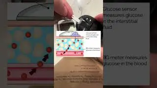 CGM Accuracy Test #2 (24 Hours In)