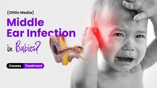 What is Middle Ear Infection (Otitis Media) in Babies? Causes and Treatment Options - 3D Guide