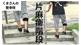 普通の人のように階段を上がりたい！『片麻痺 階段』