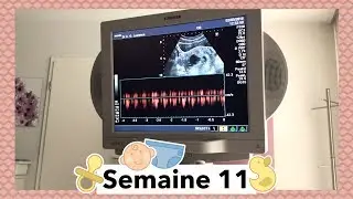 Je suis ballonn&eacute;e et stress&eacute;e - Grossesse 11 SA