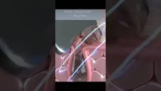 How To Remove Blackheads With bt Micro Fusion