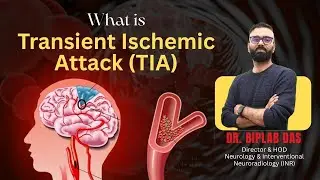 What is TIA? Transient Ischemic Attack (Mini Stroke) Symptoms, Causes & Treatment | Dr. Biplab Das