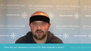 FUE Hair Transplant in Turkey | Dr. Ilker Apaydin's Patients Review from UK | 3920 Grafts