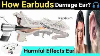 How earbuds damage our ear with high frequency?//Harmful Effects//p0wer of Medical//#earbuds#earlose
