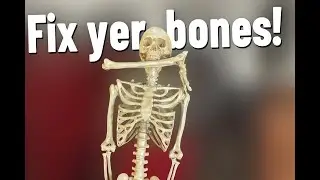 Fix yer bones! Repair skeleton knees!