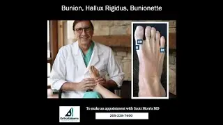 Bunion, Hallus Rigidus, Bunionette
