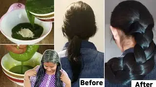 🔥7 Days Hair Miracle😱 இத பண்ணுனதான் முடி அடர்த்தியா வளரும் - Hair Growth / Reduce Hair Fall