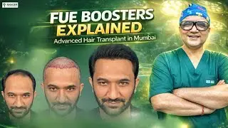 FUE Boosters Explained | Advanced Hair Transplant in Mumbai by Dr Vivek Nigam