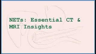 CT and MRI Scans for Neuroendocrine Tumors: What Radiologists Look For