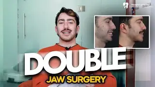 Double Jaw(Orthognathic) Surgery for Sleep Apnea patient / post surgery shares him experiance