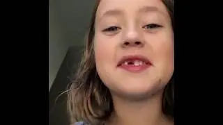 How To Get A Squirrel Eat From Your Hands