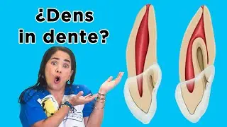 &iquest;Dens in dente?