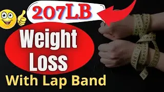 207lb Weight Loss With Lap Band