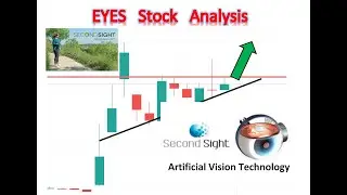 EYES Stock (SecondSight) about to explode, artificial vision technology!