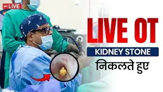 Stone is out! 🔥 Watch Dr. Anuj's LIVE RIRS Surgery #live #ot #rirs #kidneystone