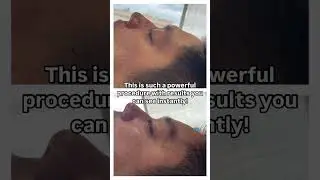 Can men get brow bone reduction? Correcting a prominent brow ridge | Dr. Sarah Saxon