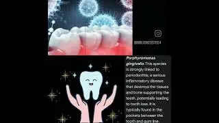 let's play hide&seek 🎮 with bacteria,protect ur teeth with cleaning from spy bacteria.!#eds#dentcare