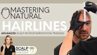 Scalp Micro Pigmentation Natural Hairline Tutorial