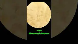 Another world that you can&rsquo;t see#microscope #micro #science #fun #world