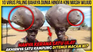 10 VIRUS PALING BAHAYA DI DUNIA HINGGA KINI MASIH WUJUD
