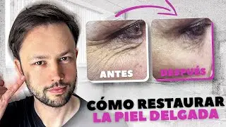 ¿Tu piel está más delgada? Descubre cómo recuperarla rápidamente