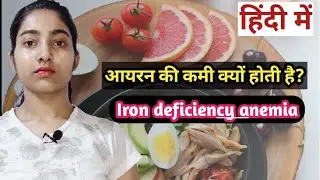 Iron deficiency anemia|Symptoms|Treatment|alka medical classes|