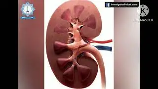 Kidneys seling Group| Kidneys Group Pakra Gia|Kidney chor Police Kay Hath Lag Gia|REALITY OF WORLDS
