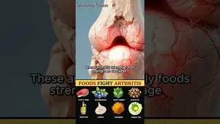8 Must-Eat Foods for Arthritis Relief and Better Joint Mobility