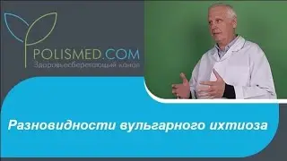 Разновидности вульгарного ихтиоза вульгарный, простой, абортивный, роговидный, блестящий
