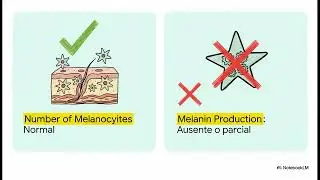 Tema 15 Discromías