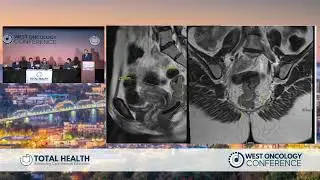 Day 1 | Panel Discussion and Q&A   Gastrointestinal Cancer
