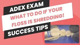 What To Do if Your Floss is Shredding During Your ADEX Exam Preps!