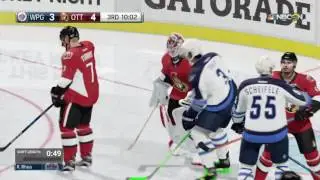 NHL 17 Be A Pro ( D-Man ) | Ep 27 | INJURY'S ALL AROUND!!