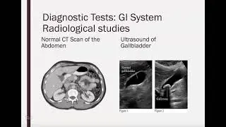 Diagnostic Tests and Procedures