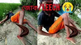 🔴 ATTACKED BY LEECHES WHILE FISHING! 😭মাছ ধরতে গিয়ে জোকের আক্রমণ 👈👈#fishing #catchingfish #vlog 