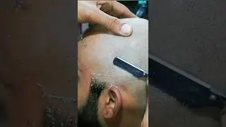 Dandruff😲head shave |Hair loss |#Buzzhaircut |hi top #fade |#scalp #viral #trending #alihairdresser