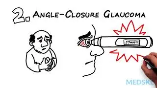 Acute Visual Loss: What You Cannot Afford To Miss with Sanjay Sharma M.D.