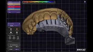 #inlab  #cerec  #millbox    #Exocad #Exoplan #Ceramill #Maestro3D #RealGuide #hyperdent  #3shape