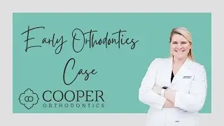 Early Orthodontics Case | Orthodontist for Teens and Adults | Houston, TX
