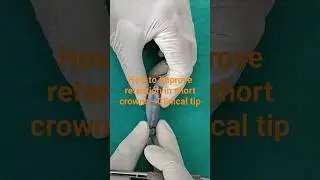 How to improve retention in short clinical crowns - Clinical tip