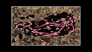New evidence that parts of Ebola virus hide in semen for months