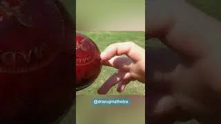 Mallet Finger Injury in Cricket Explained by Dr. Anuj | Surya Kumar Yadav Catch & Injury Connection
