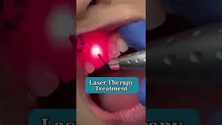 Reduce Tooth Sensitivity✨
