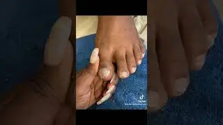 Gel X on big toes. #explore #viral #fyp #cmp #pedicure #ant #bookme