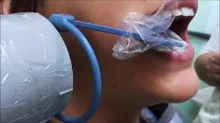 Técnica periapical com uso de posicionador para região Terceiros Molares