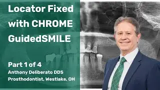 Locator Fixed with CHROME GuidedSMILE part 1 of 4
