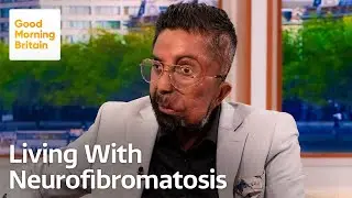 Born Different: How Amit Ghose Turned His Pain into Purpose