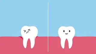 A Tale of Two Teeth