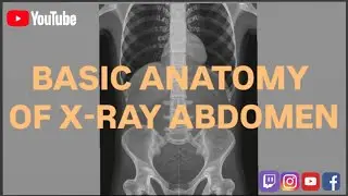 🤔Basic Anatomy Of Xray Abdomen|| how to read x ray abdomen 