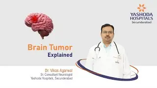 Understanding Brain Tumors: Types, Symptoms, and Treatment | Yashoda Hospitals Hyderabad
